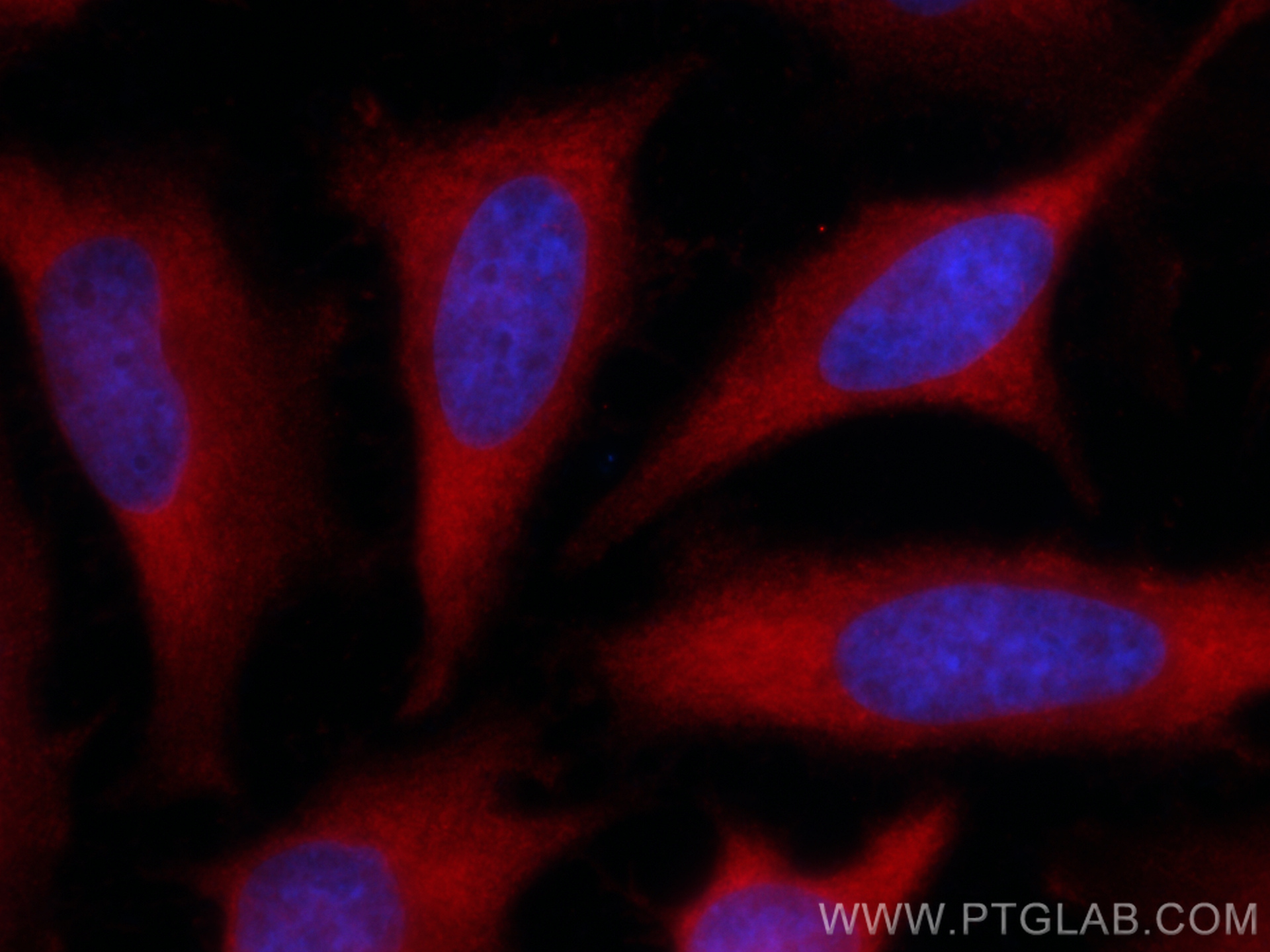 IF Staining of HeLa using CL594-67939