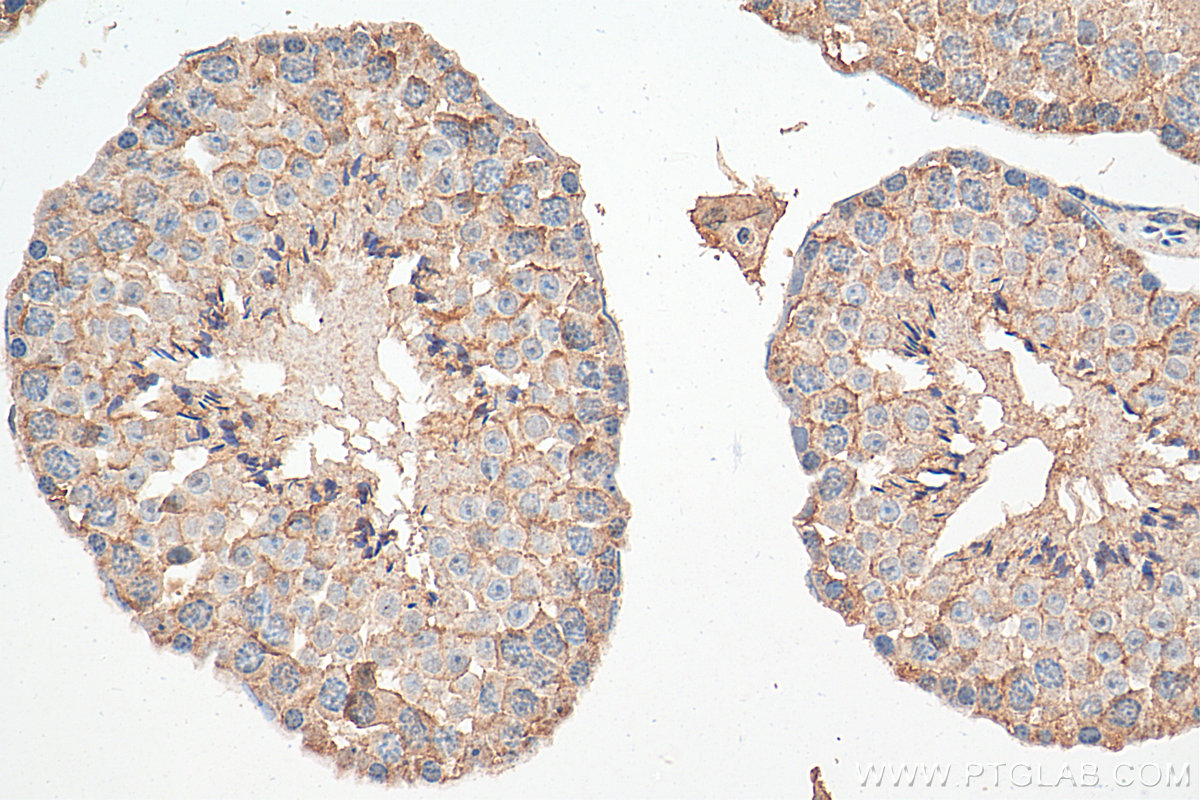 IHC staining of mouse testis using 68051-1-Ig