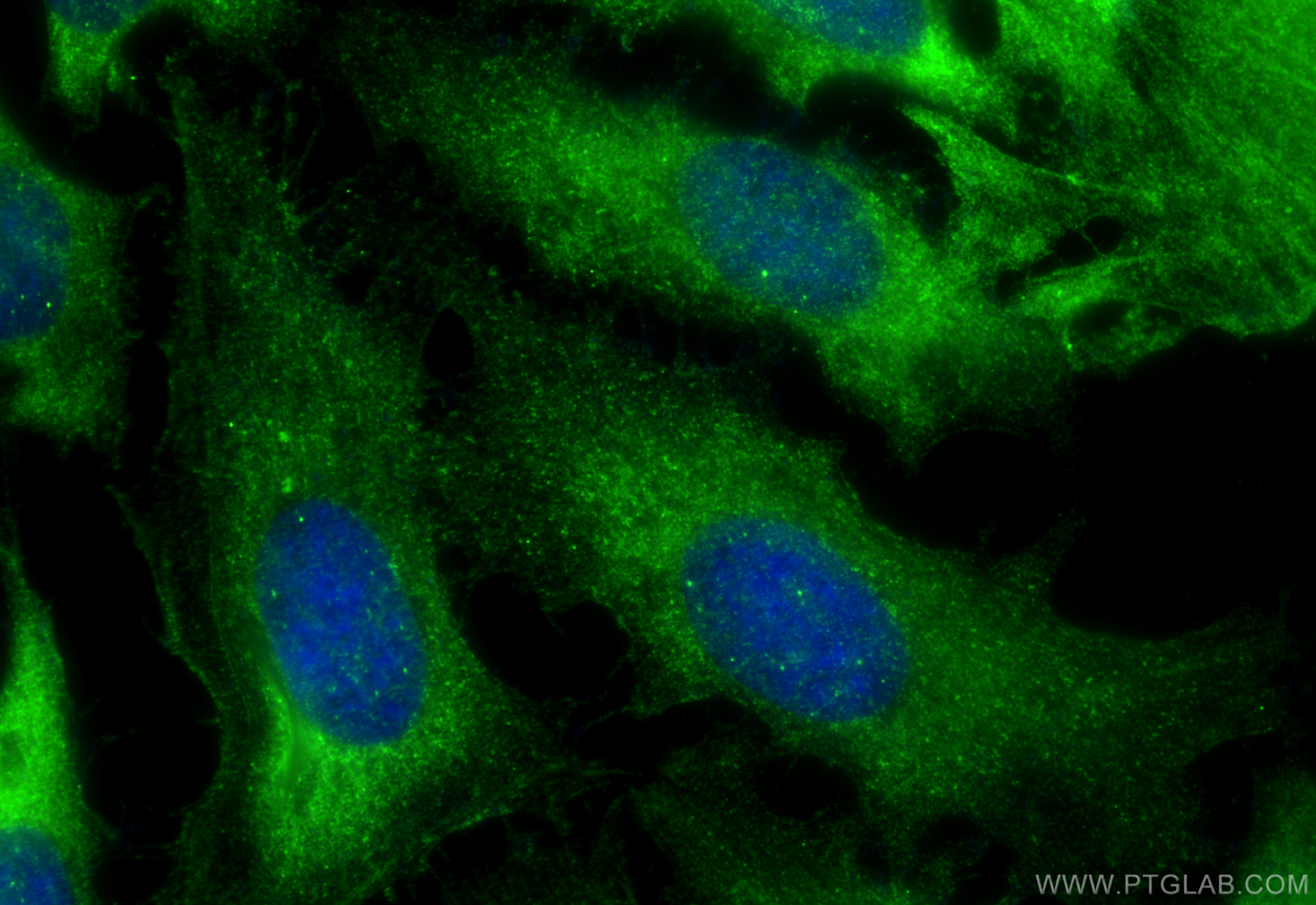 IF Staining of HeLa using 10072-1-AP