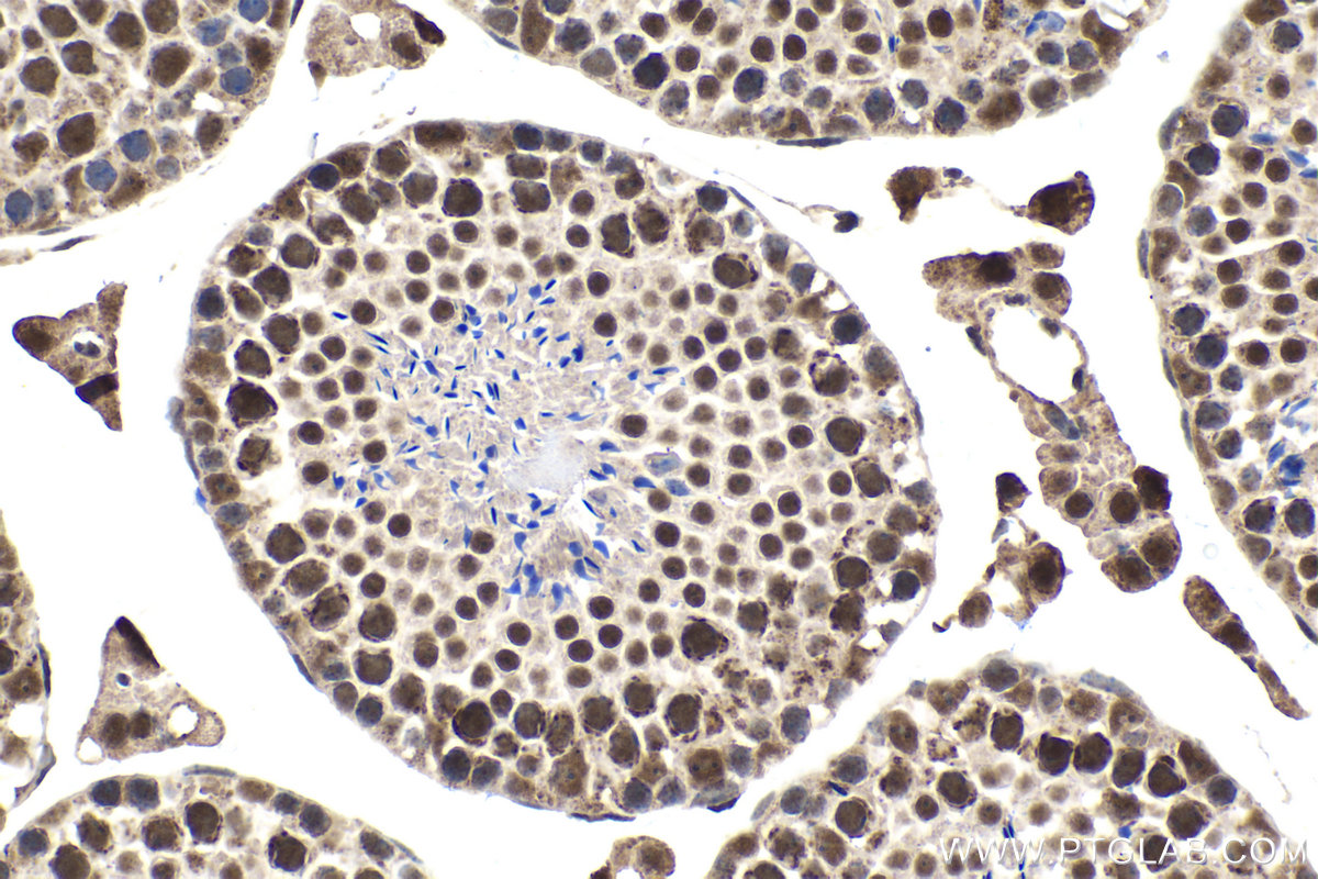 IHC staining of mouse testis using 60011-1-Ig (same clone as 60011-1-PBS)