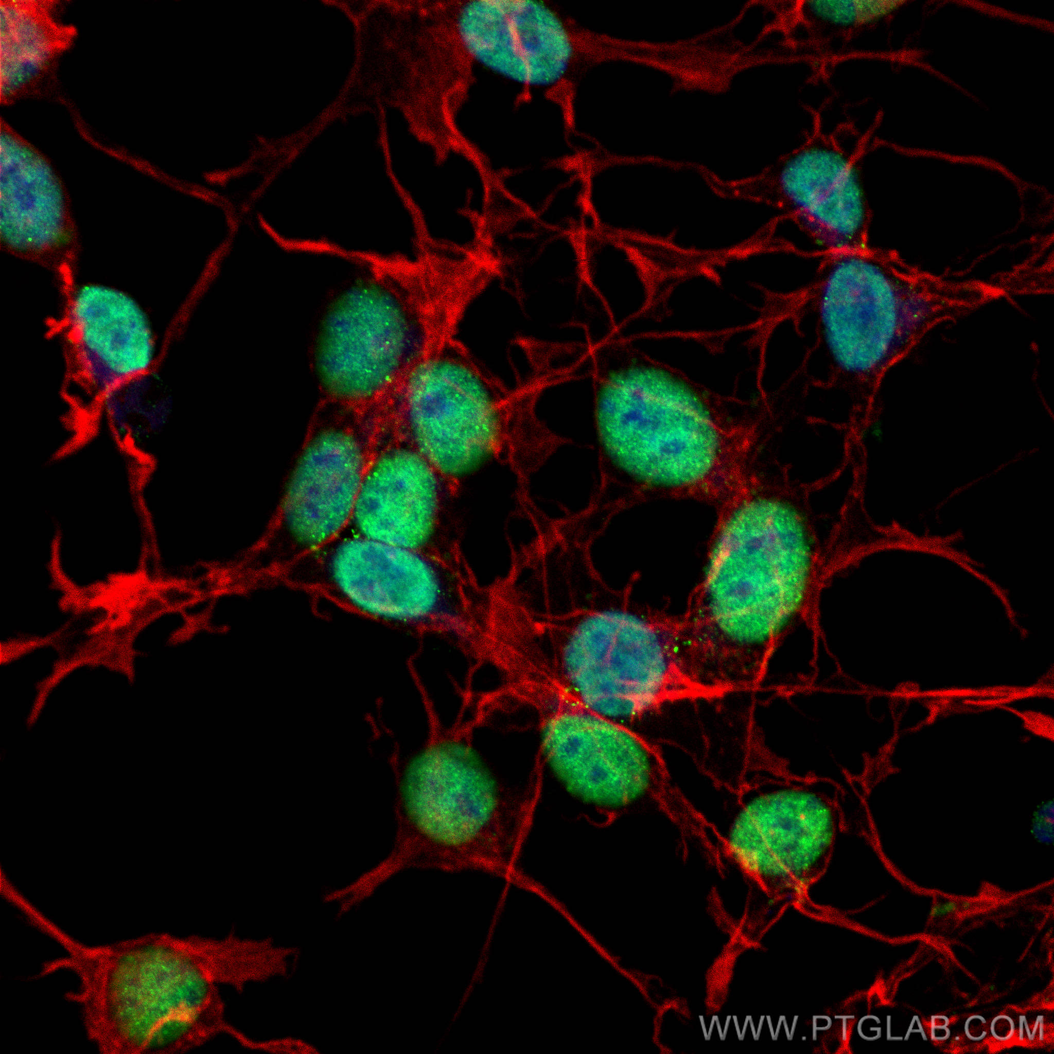 IF Staining of SH-SY5Y using 67722-1-Ig