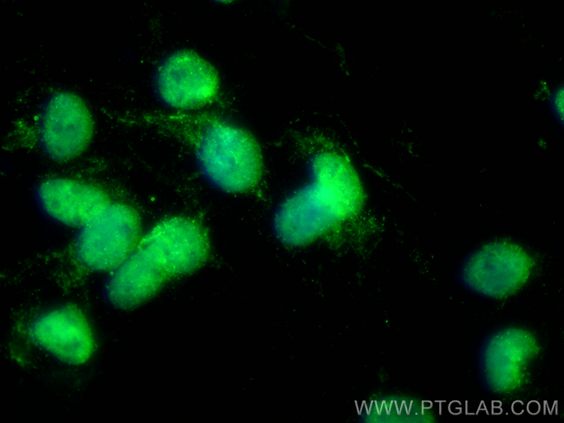 IF Staining of SH-SY5Y using CL488-67722