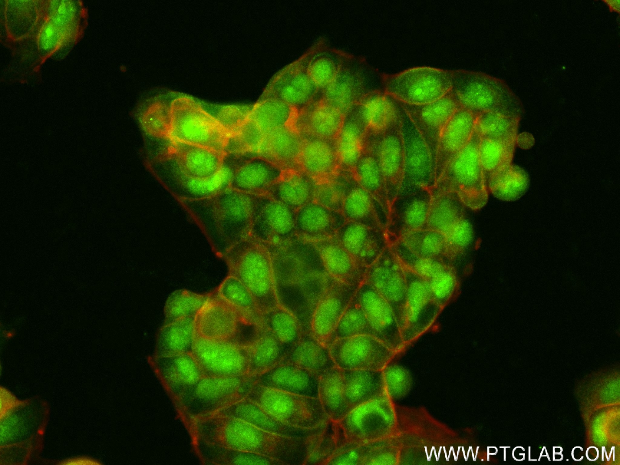 IF Staining of MCF-7 using 83808-2-RR