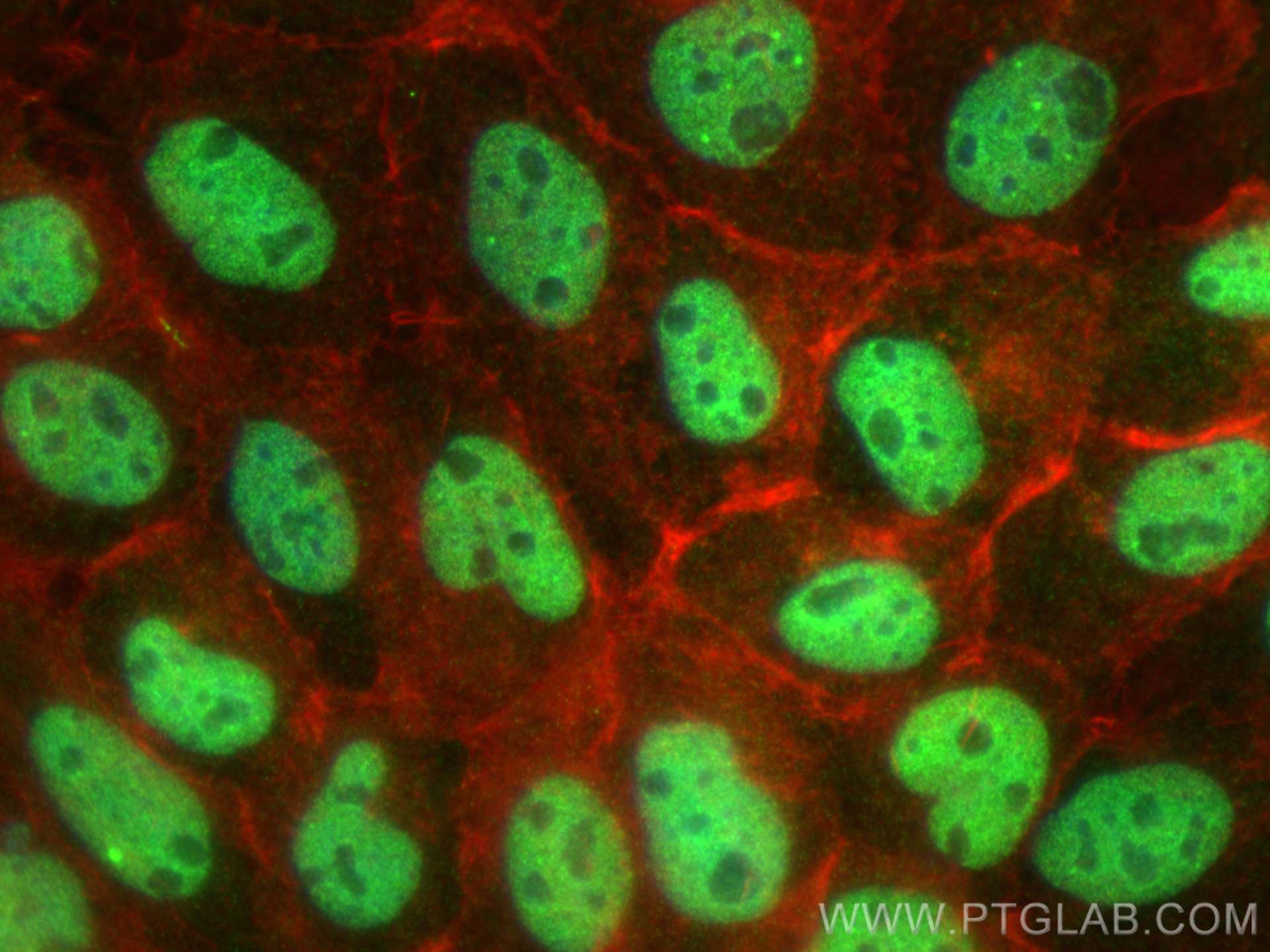 IF Staining of A431 using 25679-1-AP