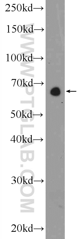 WB analysis of A549 using 25679-1-AP