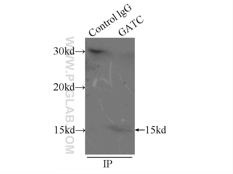 IP experiment of mouse liver using 23183-1-AP