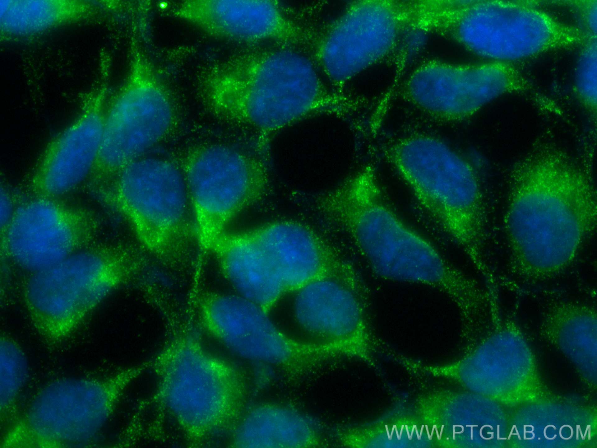 IF Staining of HEK-293 using 68405-1-Ig