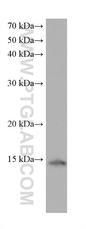 WB analysis of A549 using 68405-1-Ig (same clone as 68405-1-PBS)