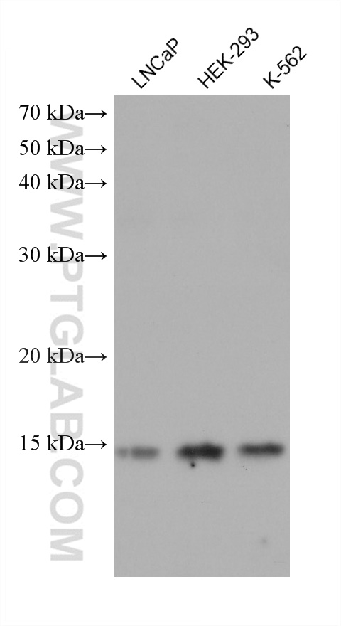 WB analysis using 68405-1-Ig (same clone as 68405-1-PBS)