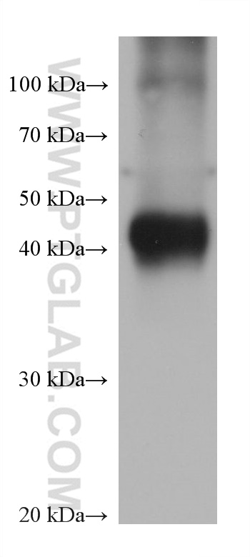 WB analysis of pig kidney using 68513-1-Ig