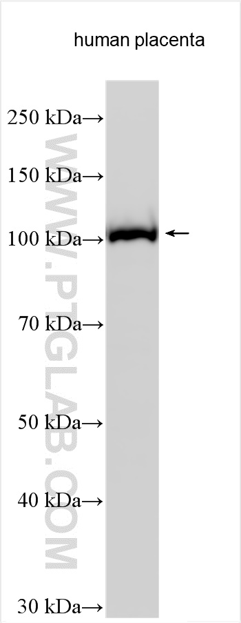 WB analysis using 17164-1-AP