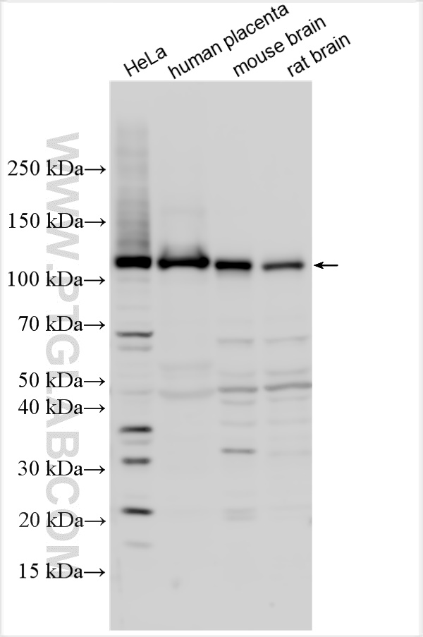 WB analysis using 17164-1-AP