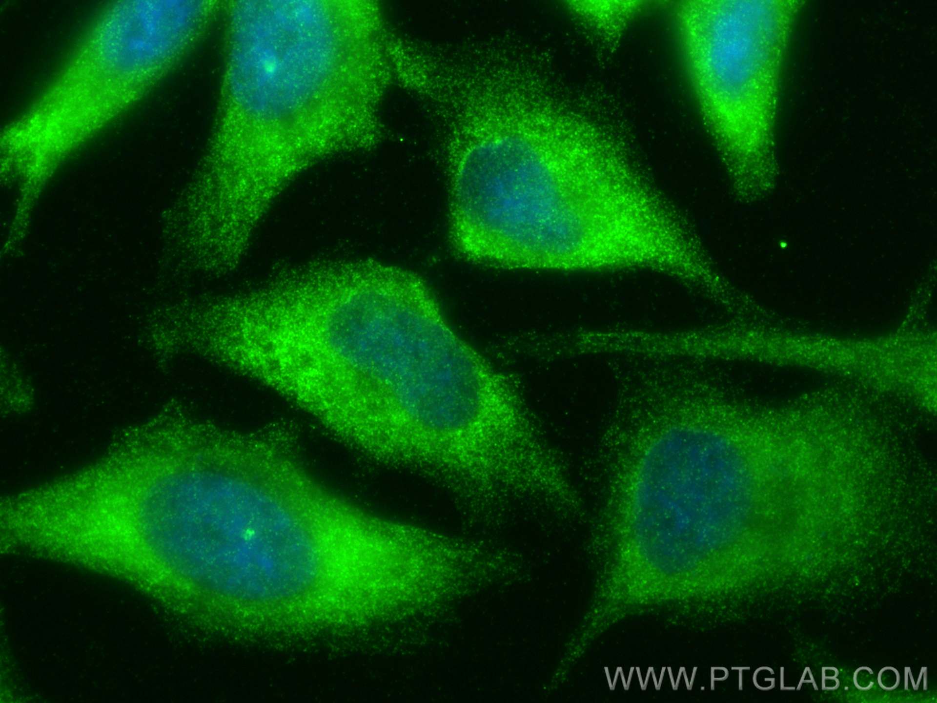 IF Staining of HeLa using 11854-1-AP