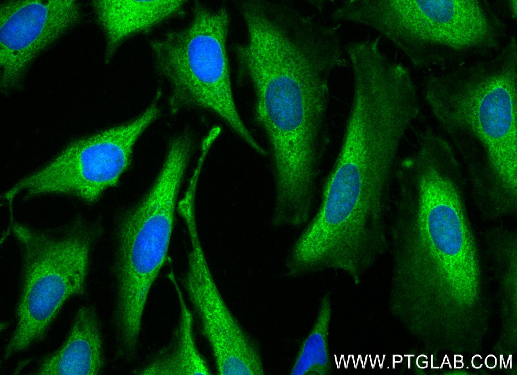 IF Staining of HeLa using 84264-6-RR