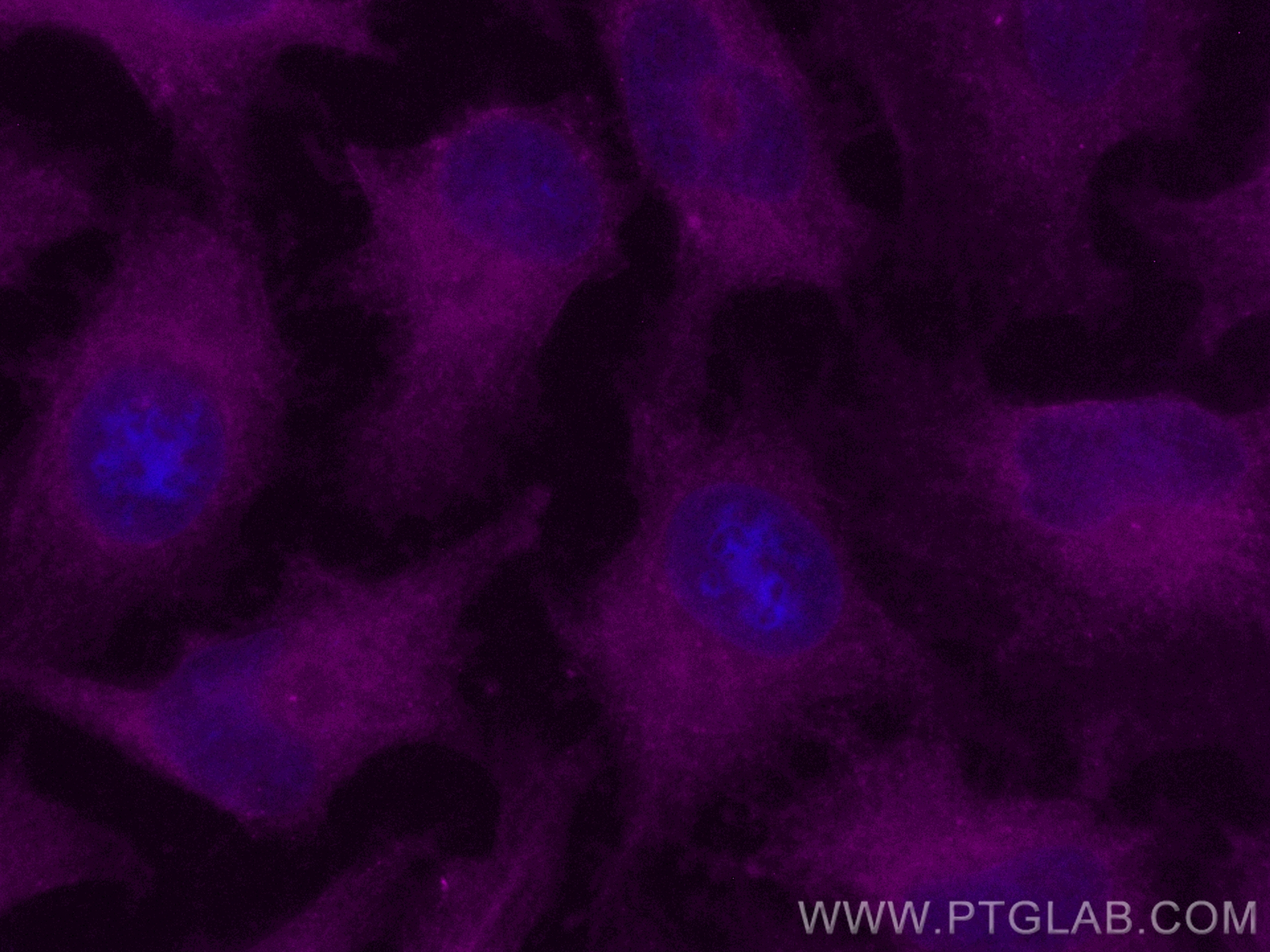 IF Staining of HeLa using CL647-11854