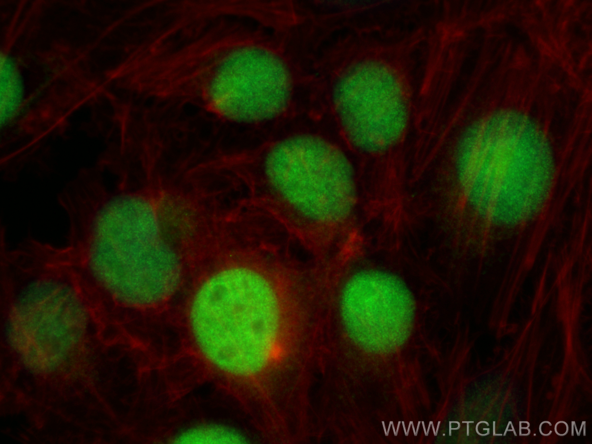 IF Staining of HeLa using 21639-1-AP