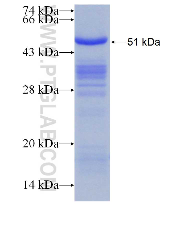 GCAT fusion protein Ag29810 SDS-PAGE