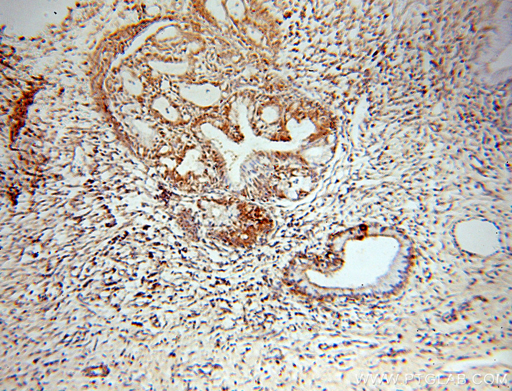 IHC staining of human cervix using 18809-1-AP