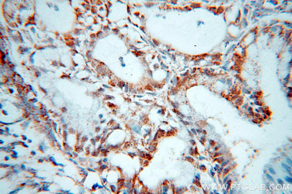 IHC staining of human cervix using 18809-1-AP