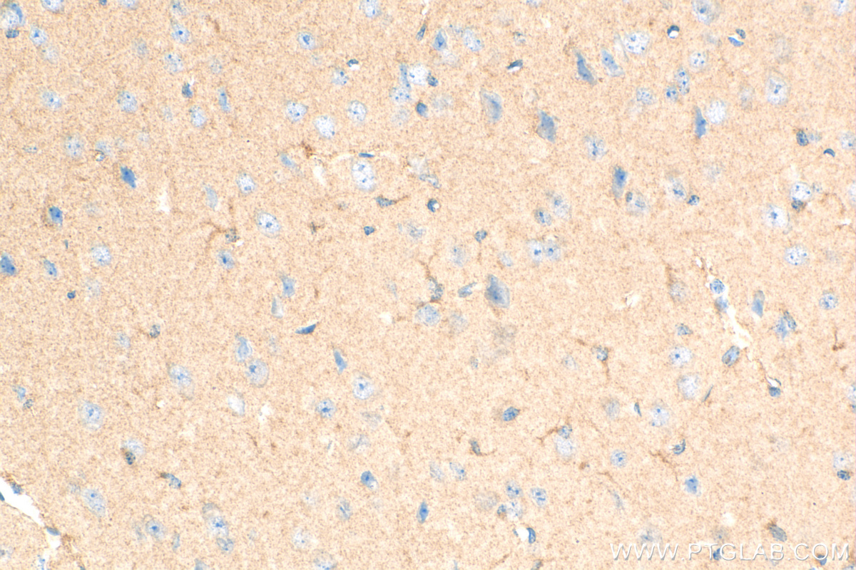 IHC staining of mouse brain using 82623-1-RR