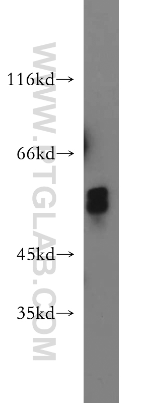 WB analysis of HEK-293 using 21088-1-AP