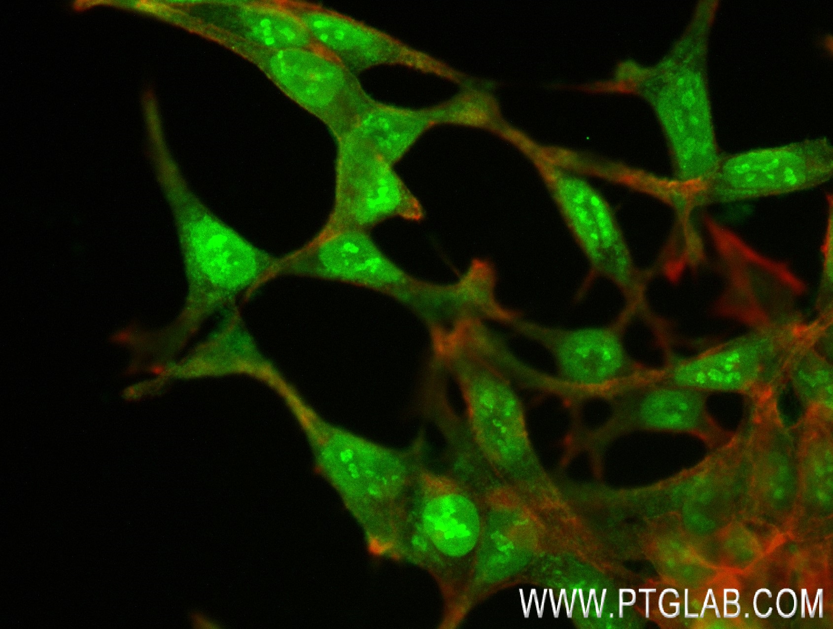 IF Staining of LNCaP using 84124-4-RR (same clone as 84124-4-PBS)