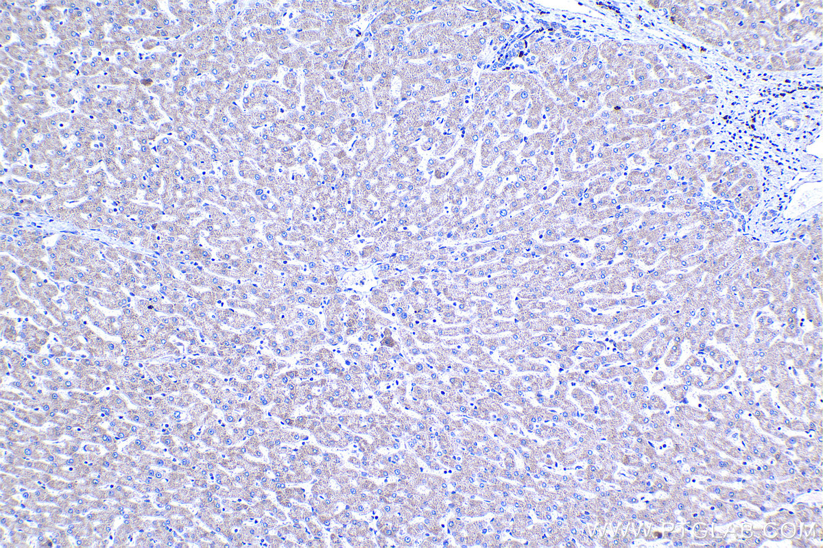 IHC staining of human liver using 18118-1-AP