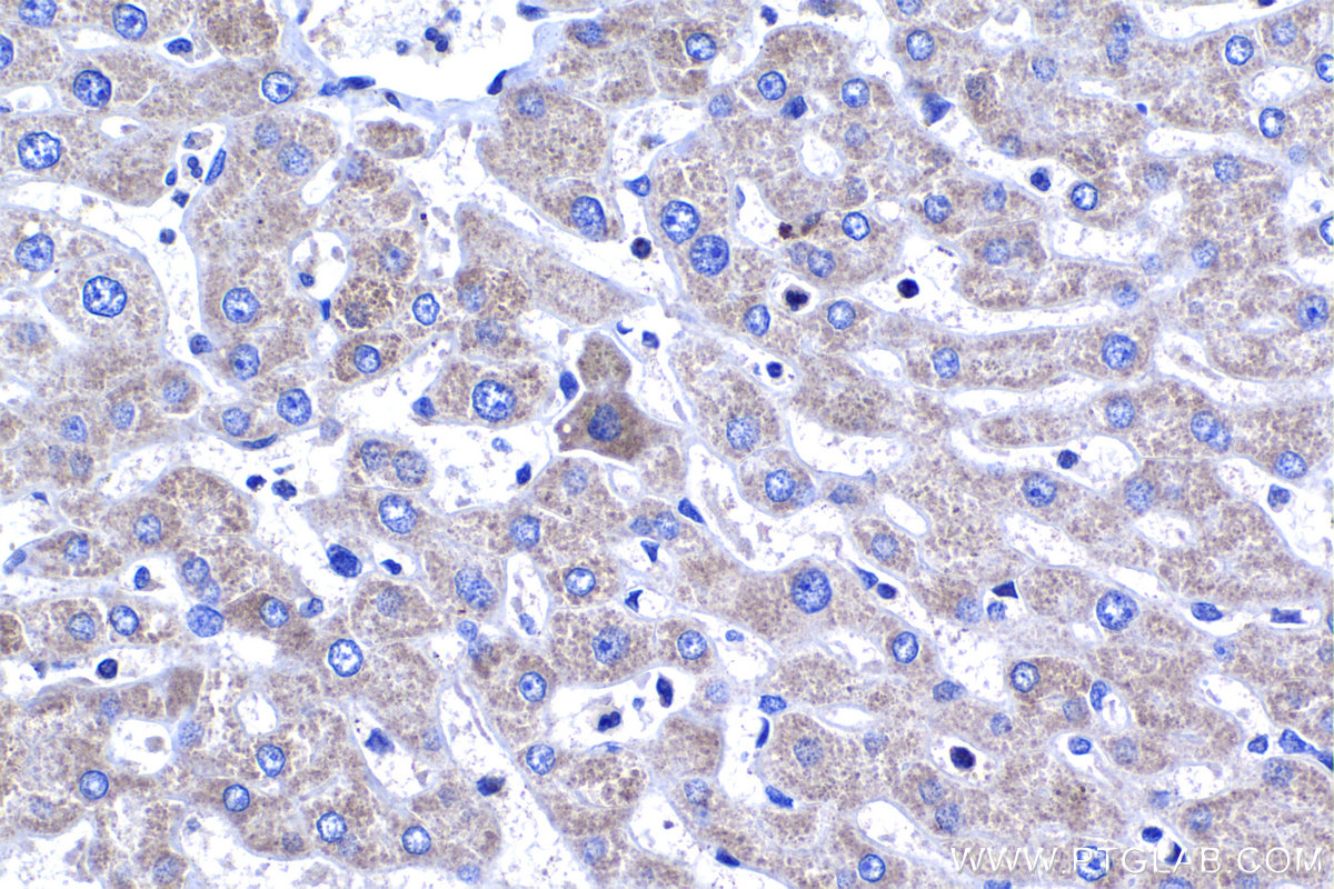 IHC staining of human liver using 18118-1-AP