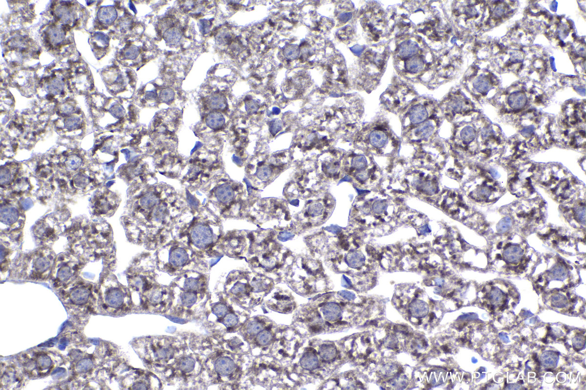 IHC staining of mouse liver using 18118-1-AP