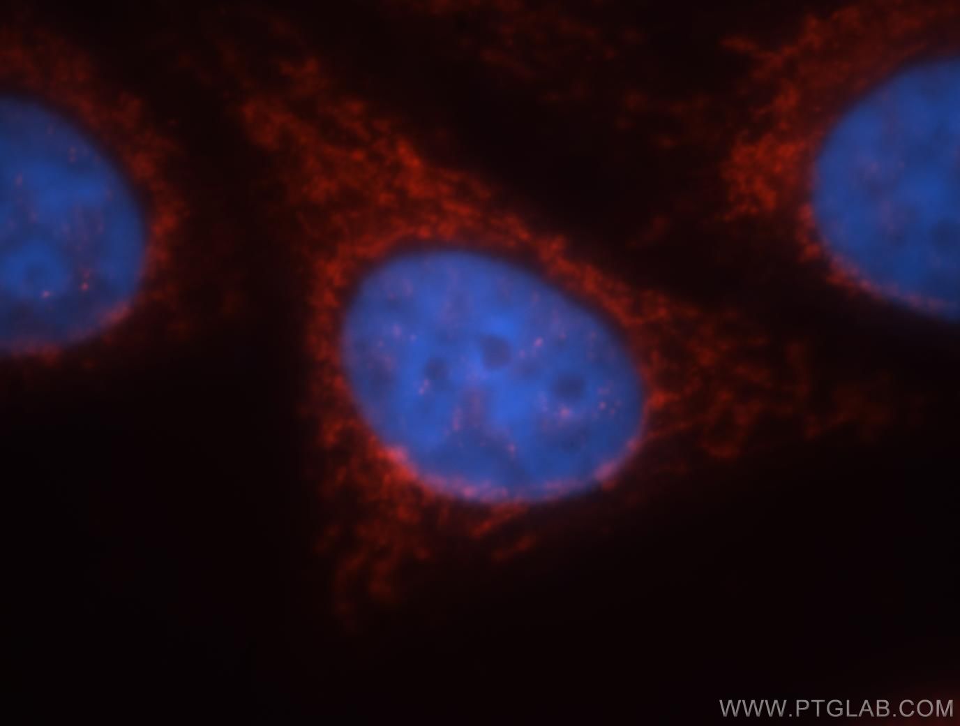 IF Staining of HepG2 using 18129-1-AP