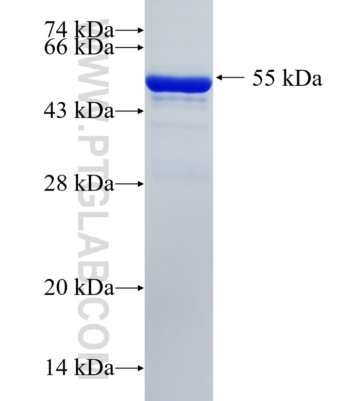 GDA fusion protein Ag35661 SDS-PAGE