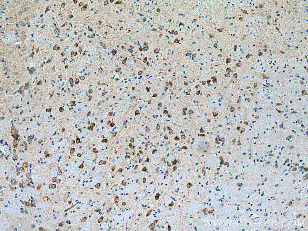 IHC staining of mouse brain using 13152-1-AP