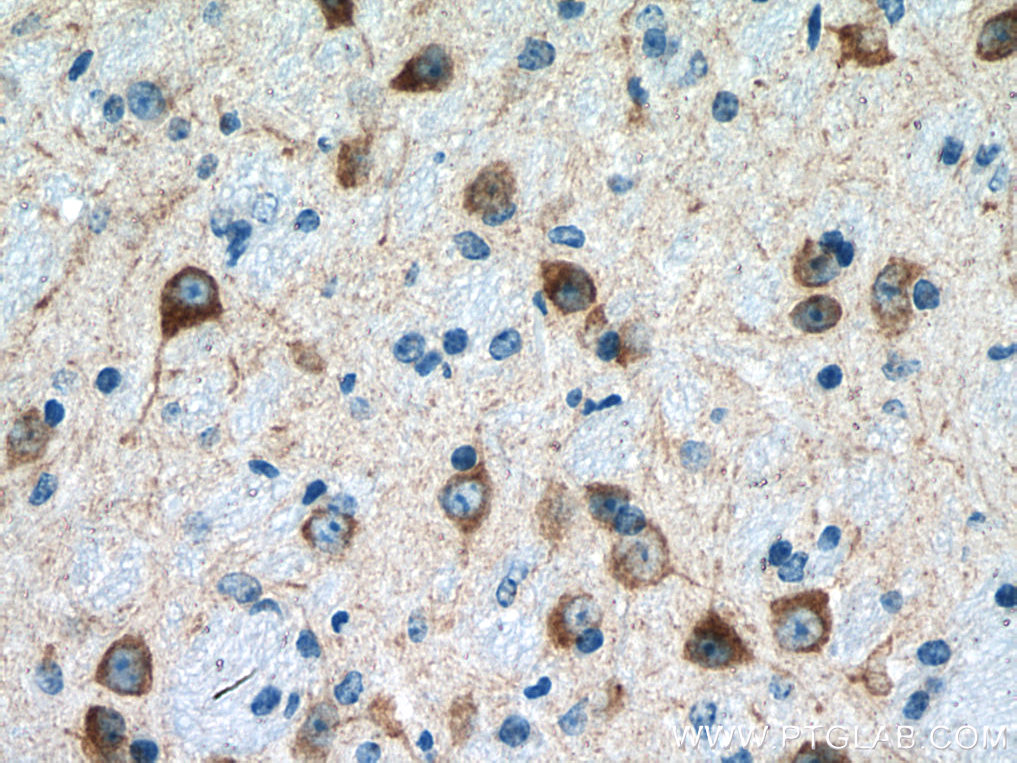 IHC staining of mouse brain using 13152-1-AP