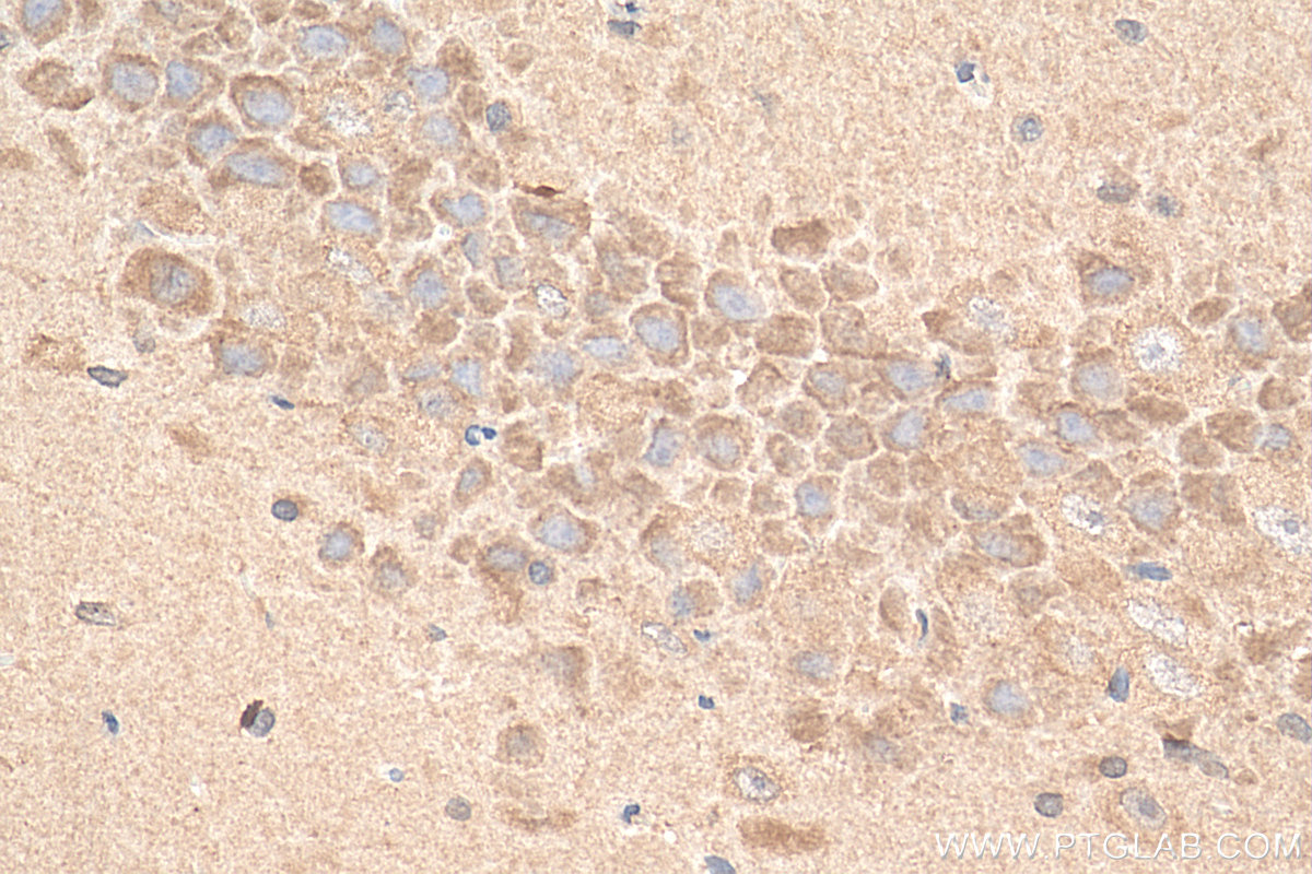 IHC staining of rat brain using 68083-1-Ig (same clone as 68083-1-PBS)