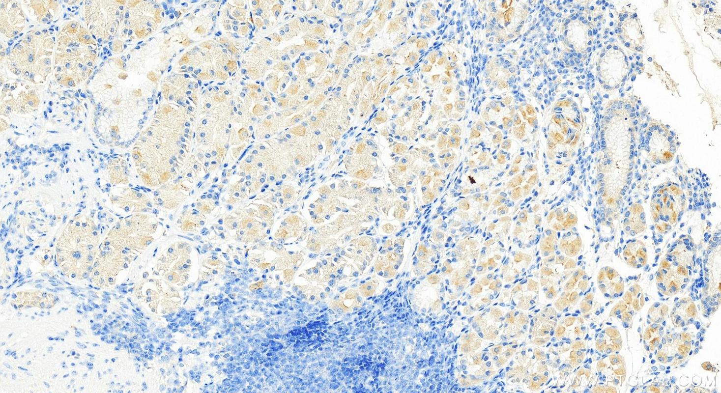 IHC staining of human stomach using 17246-1-AP