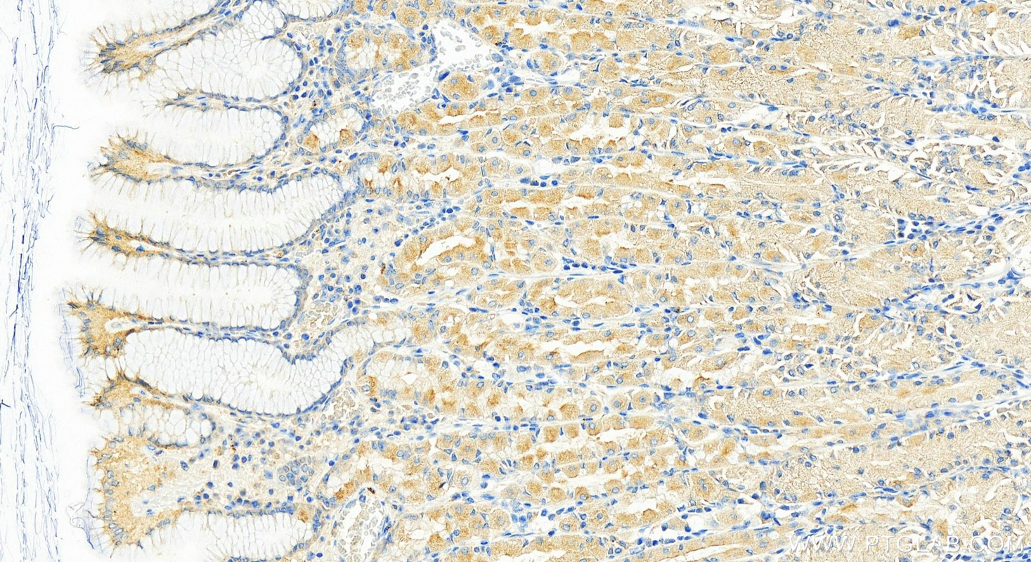 IHC staining of human stomach using 17246-1-AP