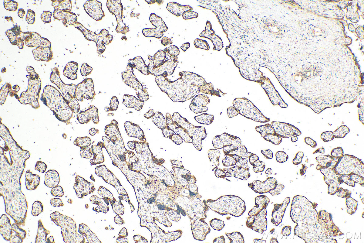 IHC staining of human placenta using 27845-1-AP