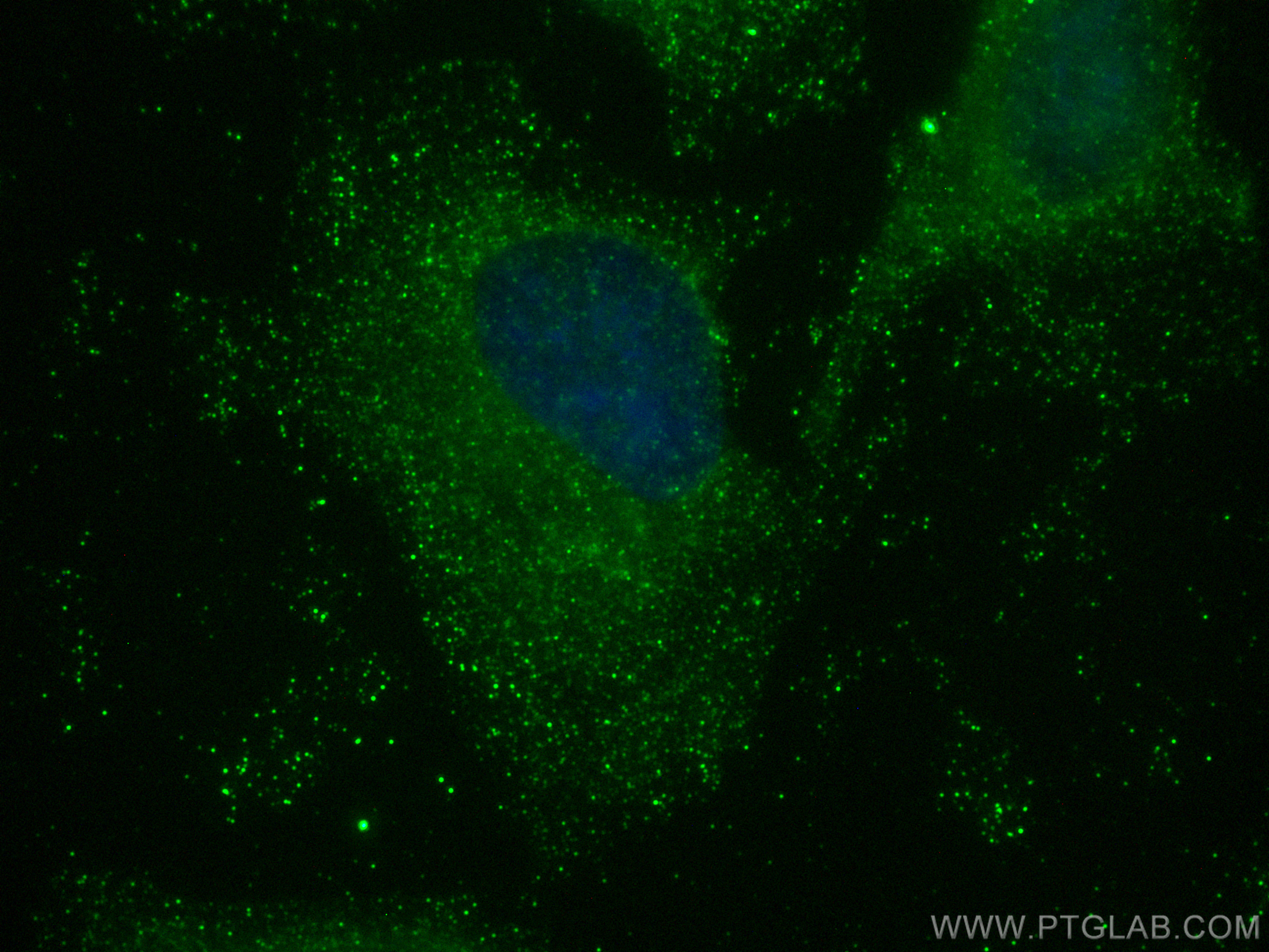 IF Staining of HeLa using 68768-1-Ig (same clone as 68768-1-PBS)