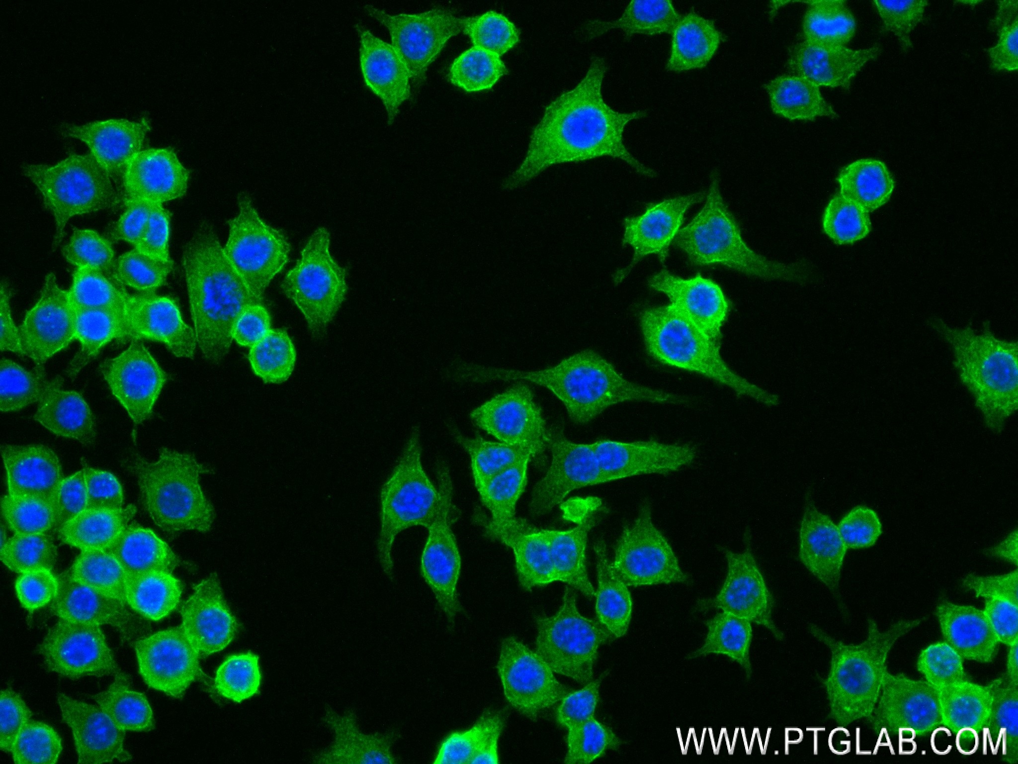 IF Staining of RAW 264.7 using 83988-4-RR