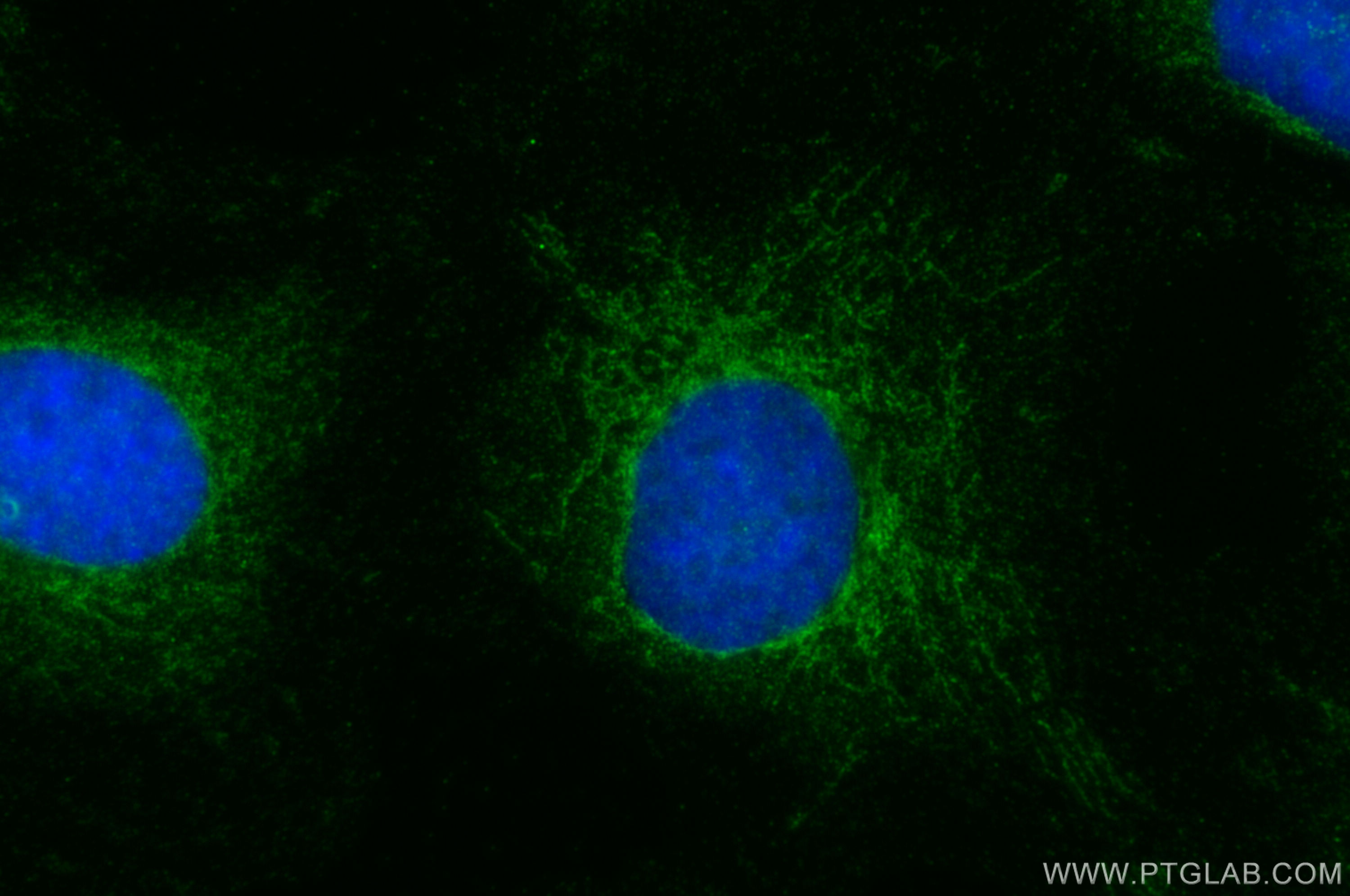 IF Staining of SKOV-3 using 29309-1-AP