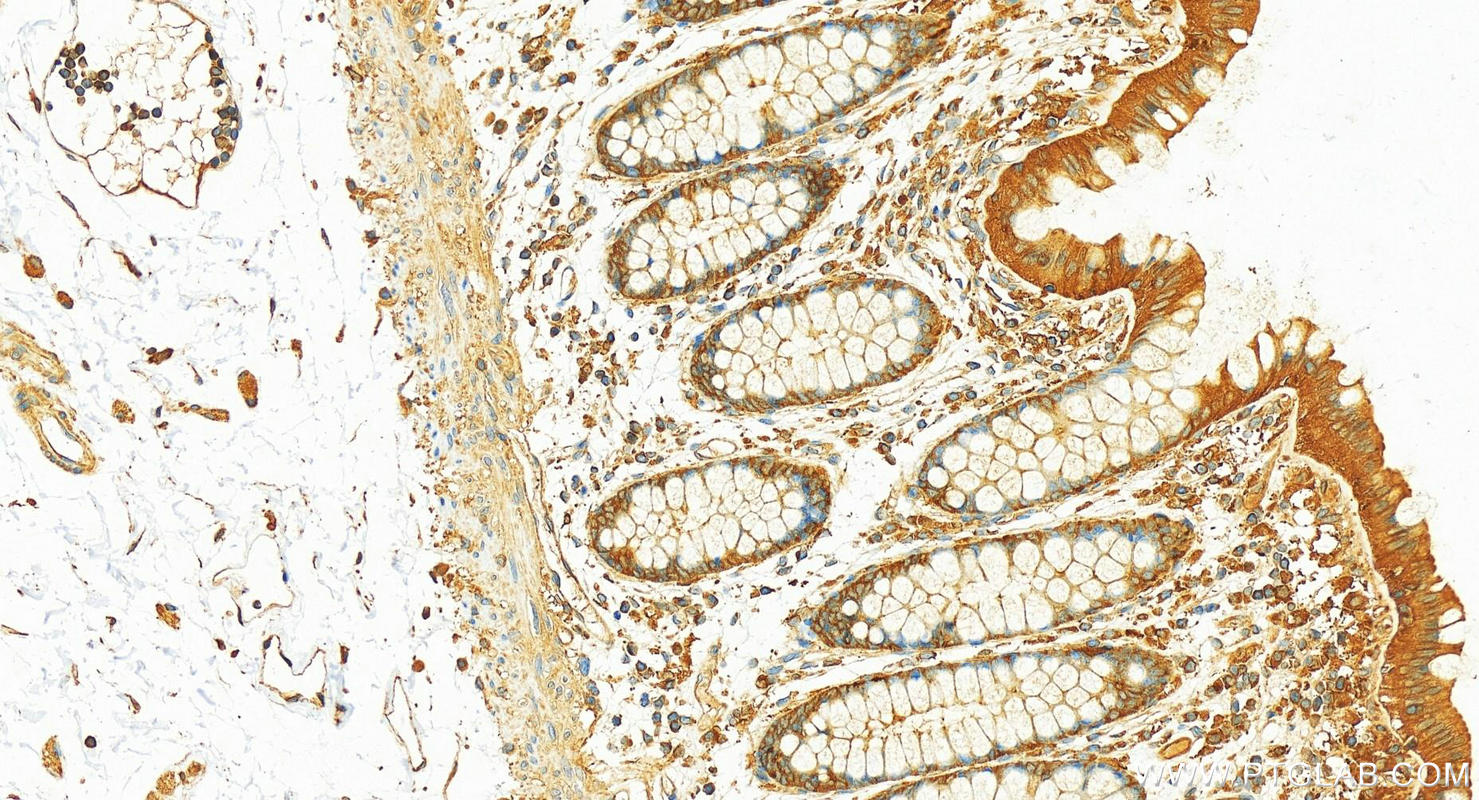 IHC staining of human colon using 10116-1-AP