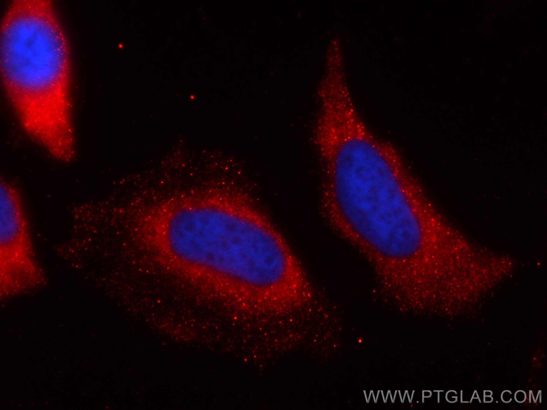 IF Staining of HeLa using CL594-60078