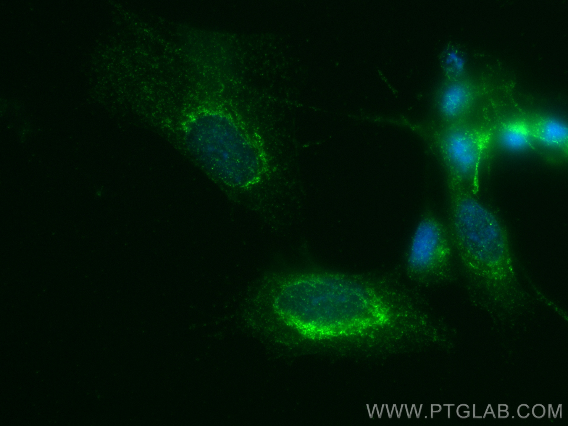 IF Staining of SH-SY5Y using 83087-1-RR