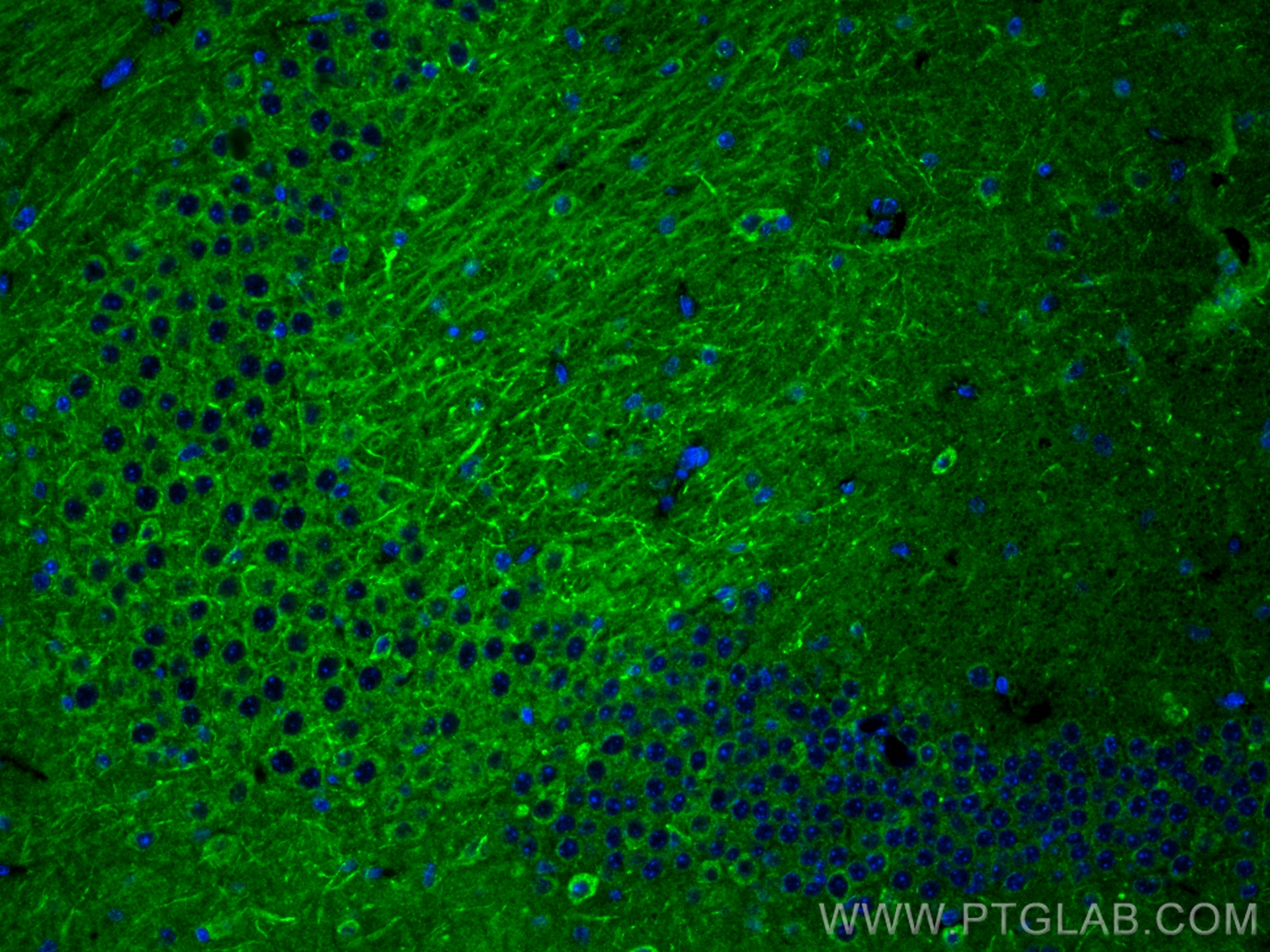 IF Staining of mouse brain using 83087-1-RR