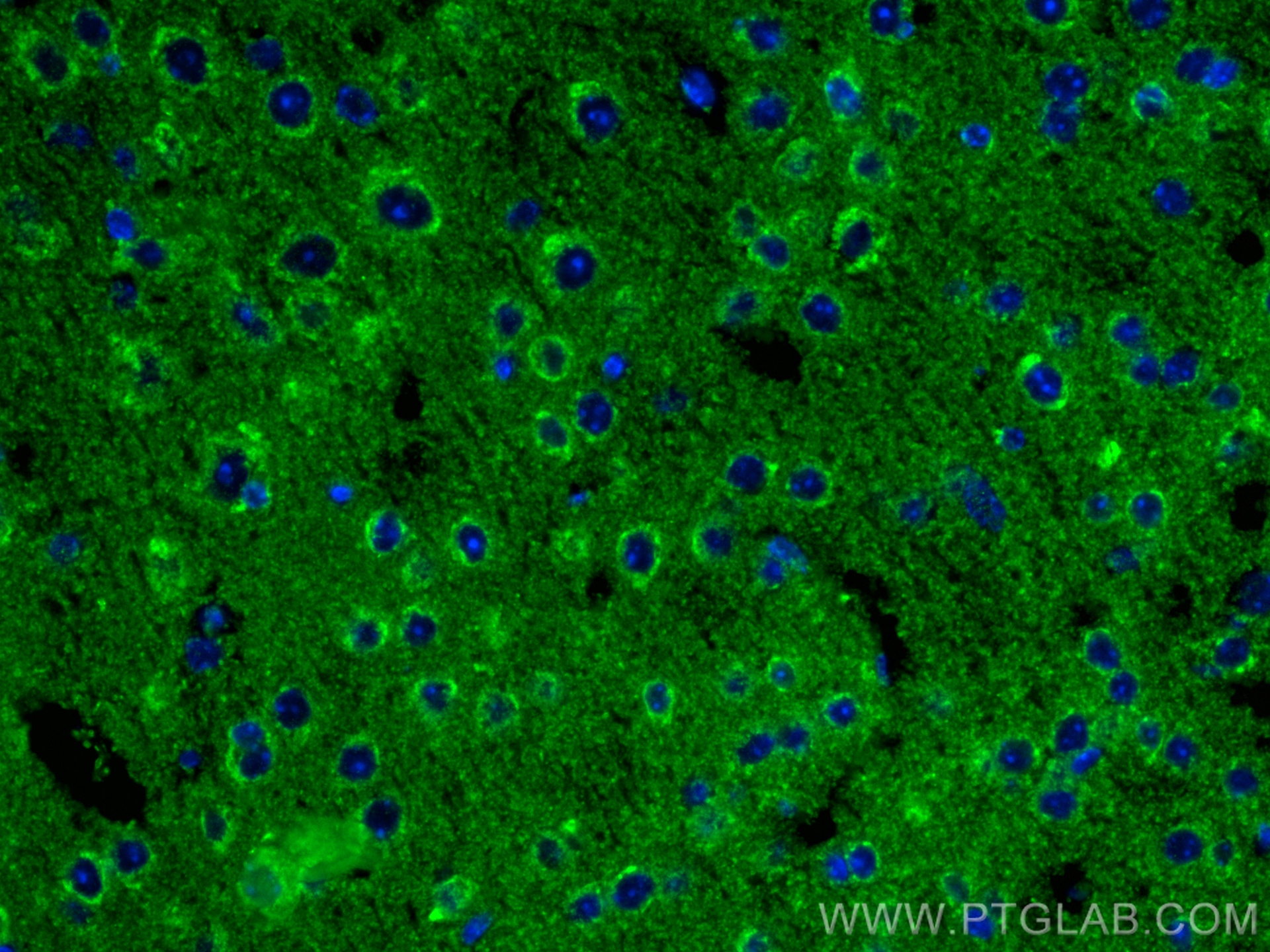 IF Staining of mouse brain using 83087-1-RR