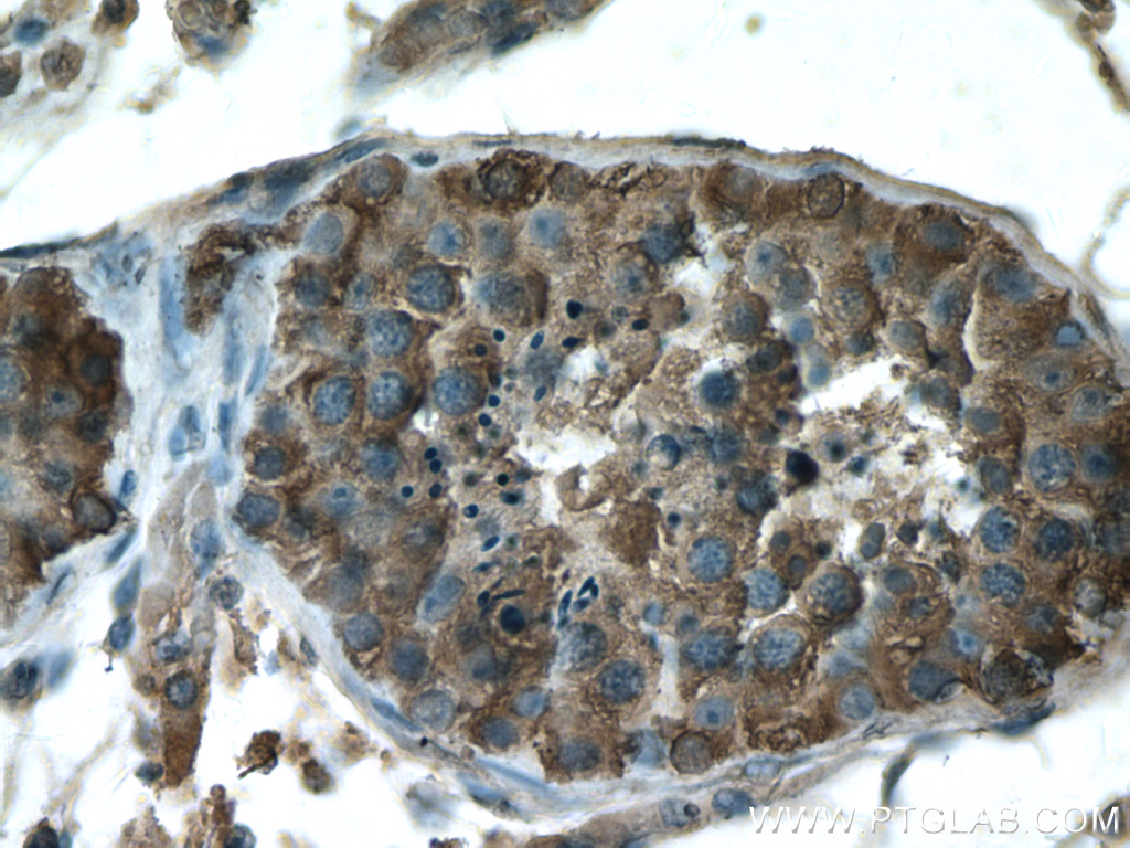 IHC staining of human testis using 27861-1-AP