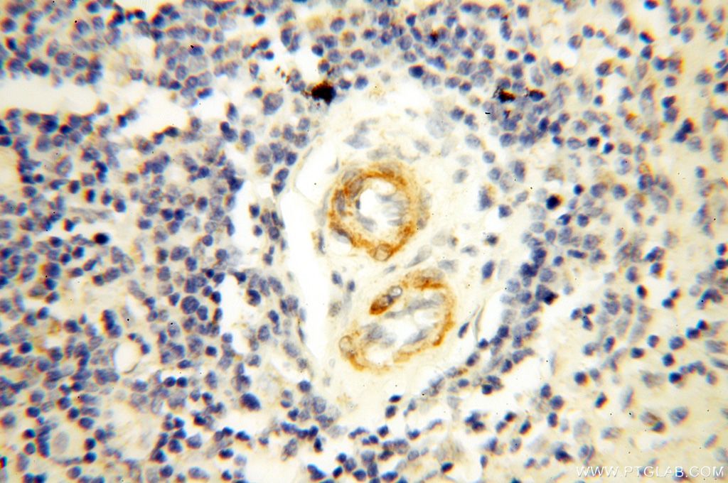 IHC staining of human spleen using 16494-1-AP