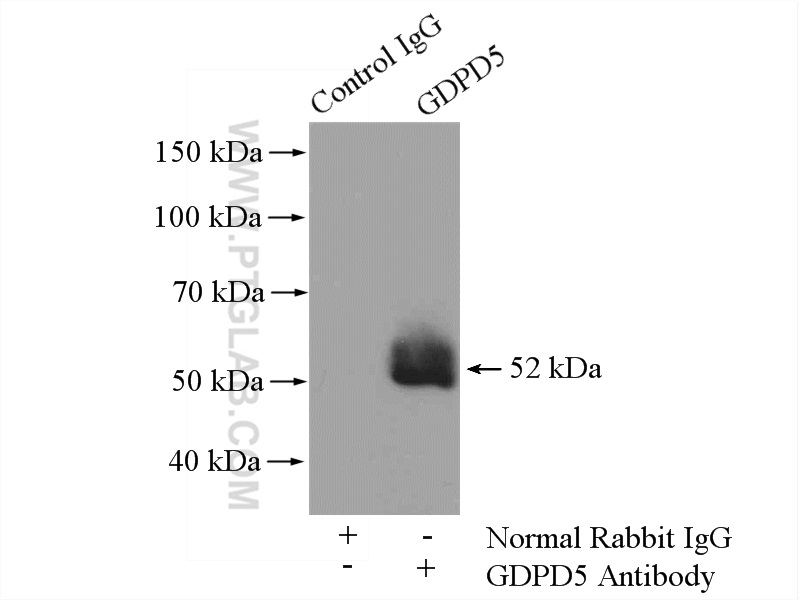 IP experiment of mouse skeletal muscle using 16494-1-AP