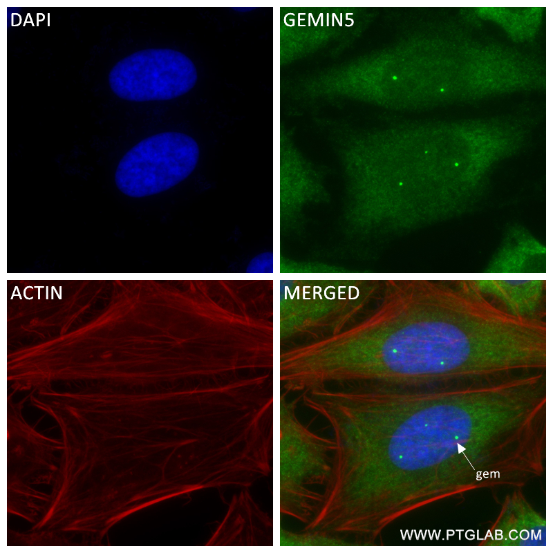 IF Staining of HeLa using 84171-3-RR (same clone as 84171-3-PBS)