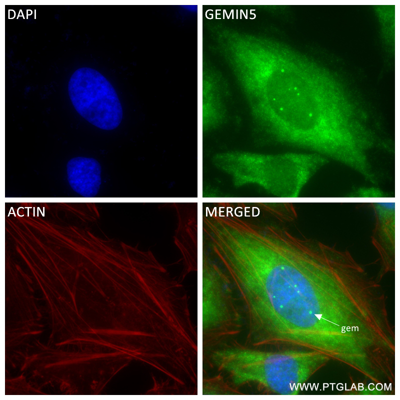 IF Staining of HeLa using 84171-5-RR (same clone as 84171-5-PBS)